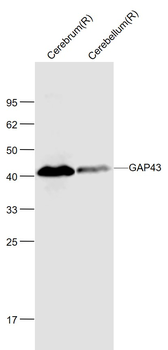 GAP43 Mouse Monoclonal Antibody