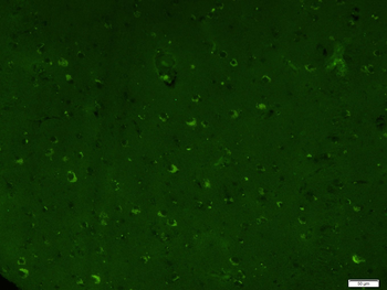 EGFR Mouse Monoclonal Antibody