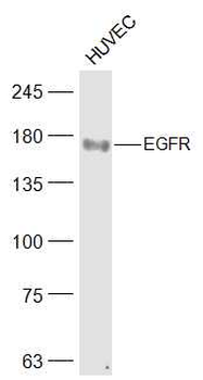 EGFR Mouse Monoclonal Antibody