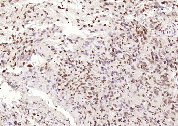 P53 (Mono Methyl Lys370) Mouse Monoclonal Antibody