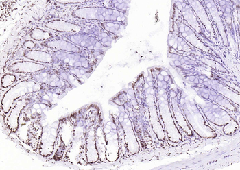 P53 (Mono Methyl Lys370) Mouse Monoclonal Antibody
