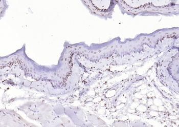 P53 (Mono Methyl Lys370) Mouse Monoclonal Antibody