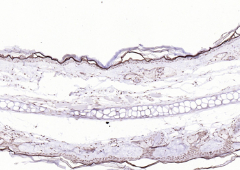 P53 (Mono Methyl Lys370) Mouse Monoclonal Antibody