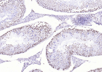 P53 (Mono Methyl Lys370) Mouse Monoclonal Antibody