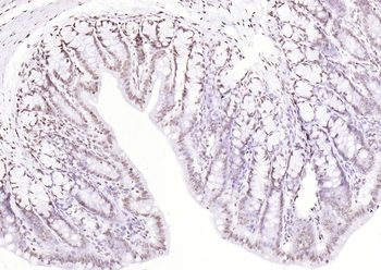 P53 (Mono Methyl Lys370) Mouse Monoclonal Antibody