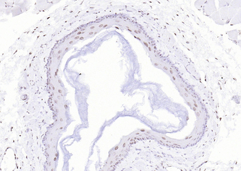P53 (Mono Methyl Lys370) Mouse Monoclonal Antibody