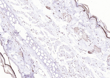 P53 (Mono Methyl Lys370) Mouse Monoclonal Antibody