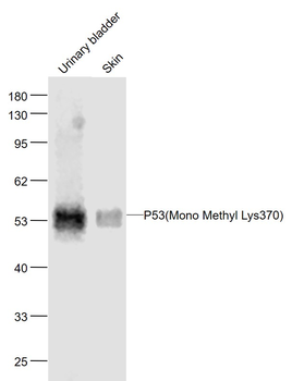 P53 (Mono Methyl Lys370) Mouse Monoclonal Antibody