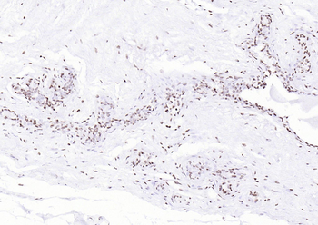 P53 (Mono Methyl Lys370) Mouse Monoclonal Antibody