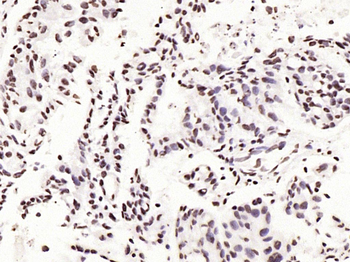 P53 (Mono Methyl Lys370) Mouse Monoclonal Antibody