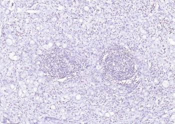 P53 (Mono Methyl Lys370) Mouse Monoclonal Antibody