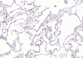 P53 (Mono Methyl Lys370) Mouse Monoclonal Antibody