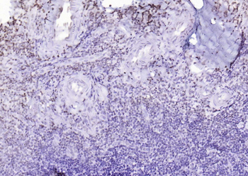 P53 (Mono Methyl Lys370) Mouse Monoclonal Antibody