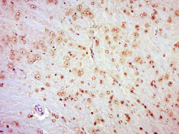 FOXO1 Rabbit Polyclonal Antibody