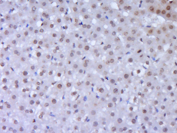 ROR gamma T Rabbit Polyclonal Antibody