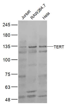 TERT Rabbit Polyclonal Antibody