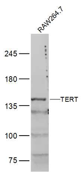 TERT Rabbit Polyclonal Antibody