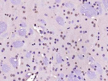 Nurr1 Rabbit Polyclonal Antibody