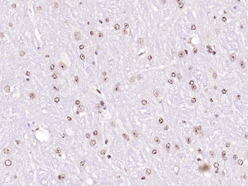 Nurr1 Rabbit Polyclonal Antibody