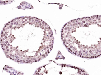 Nurr1 Rabbit Polyclonal Antibody