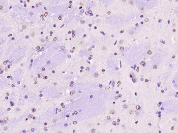 Nurr1 Rabbit Polyclonal Antibody