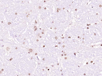 Nurr1 Rabbit Polyclonal Antibody