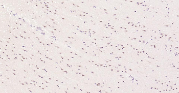 Nurr1 Rabbit Polyclonal Antibody