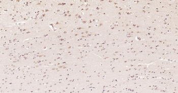 Nurr1 Rabbit Polyclonal Antibody
