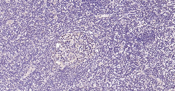 Nurr1 Rabbit Polyclonal Antibody