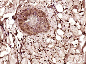 Livin Rabbit Polyclonal Antibody