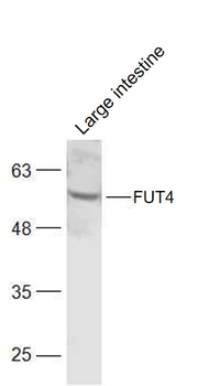 FUT4 Rabbit Polyclonal Antibody