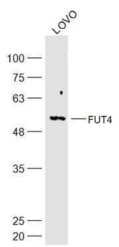 FUT4 Rabbit Polyclonal Antibody