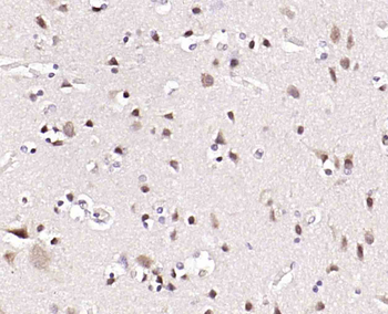NUCB2 Rabbit Polyclonal Antibody