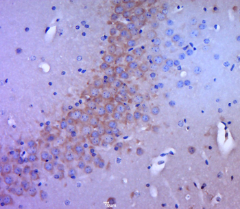 PSD95 Rabbit Polyclonal Antibody