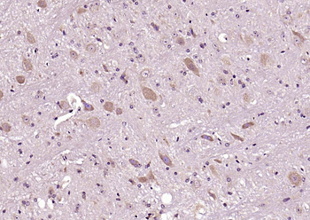 PSD95 Rabbit Polyclonal Antibody