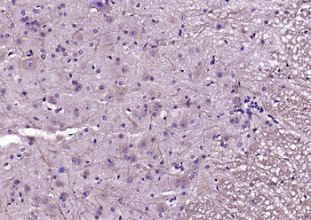 PSD95 Rabbit Polyclonal Antibody