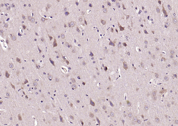 PSD95 Rabbit Polyclonal Antibody