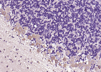 PSD95 Rabbit Polyclonal Antibody