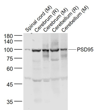 PSD95 Rabbit Polyclonal Antibody