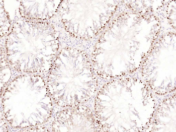 FSH receptor Rabbit Polyclonal Antibody