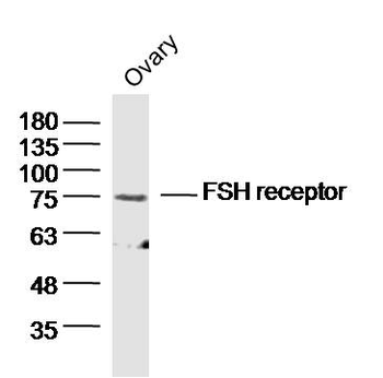 FSH receptor Rabbit Polyclonal Antibody