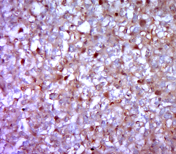 RASSF1A Rabbit Polyclonal Antibody
