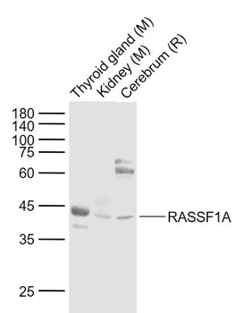 RASSF1A Rabbit Polyclonal Antibody