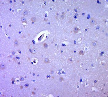 HTRA2 Rabbit Polyclonal Antibody