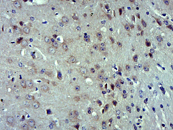HTRA2 Rabbit Polyclonal Antibody