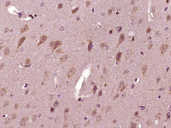 HTRA2 Rabbit Polyclonal Antibody