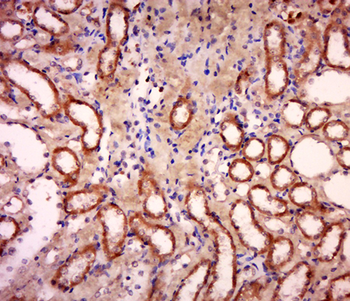 HTRA2 Rabbit Polyclonal Antibody