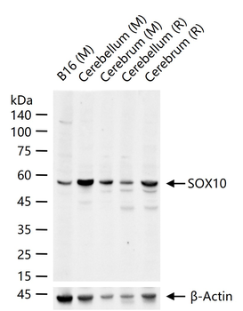 SOX10 Rabbit Polyclonal Antibody