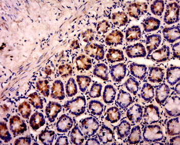 SOX10 Rabbit Polyclonal Antibody