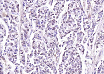 HIF-1 Alpha Rabbit Polyclonal Antibody